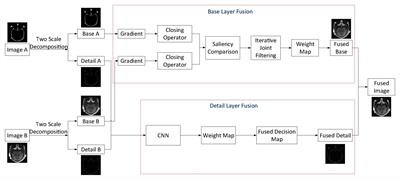 Two-Scale Multimodal Medical Image Fusion Based on Structure Preservation